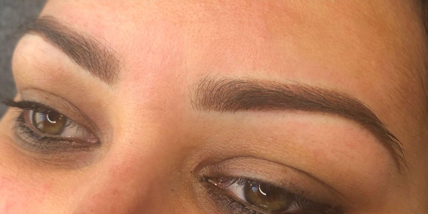 After the treatment