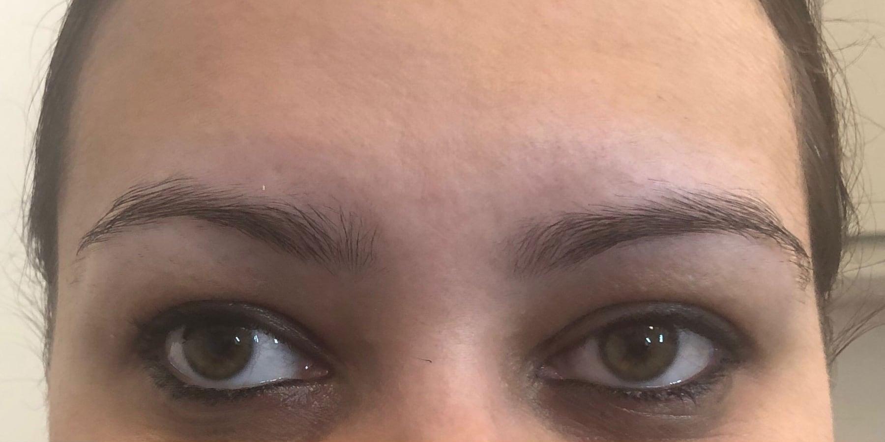 Before the treatment