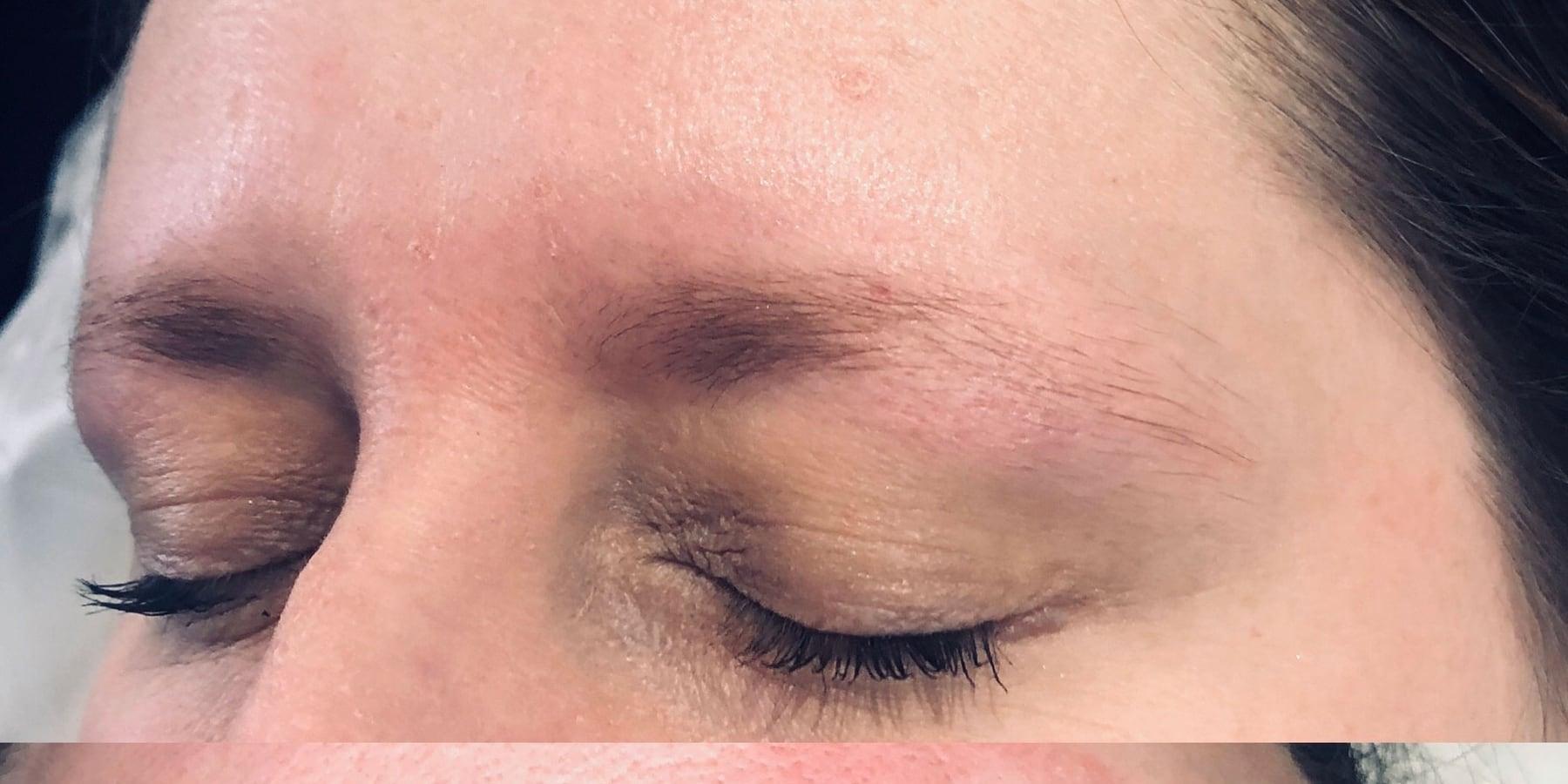 Before the treatment