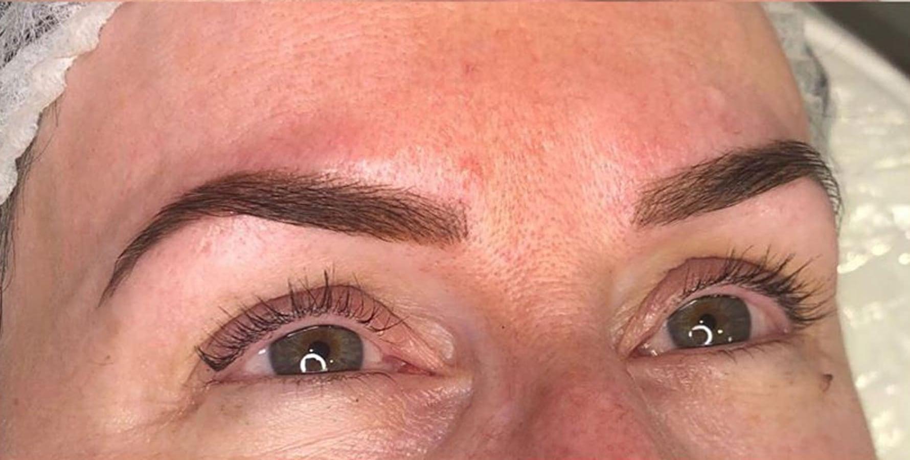 After the treatment