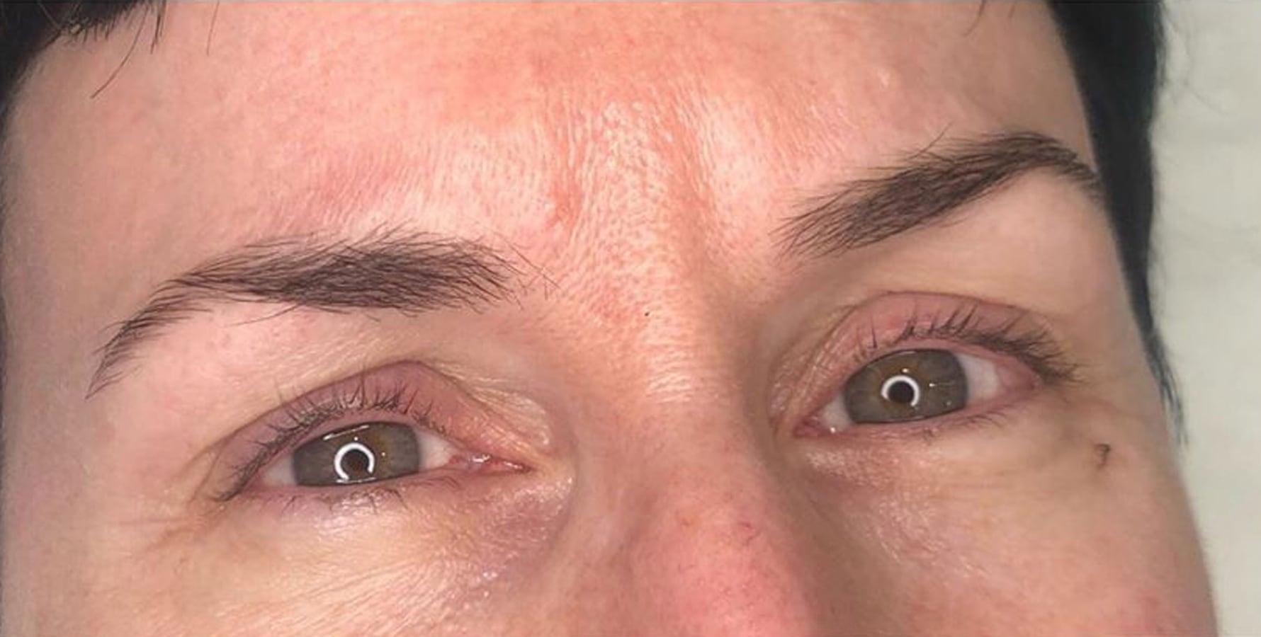 Before the treatment