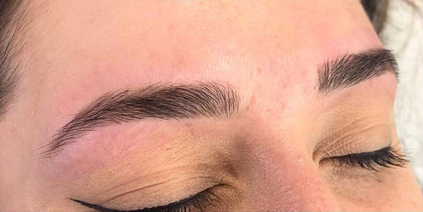 After the treatment
