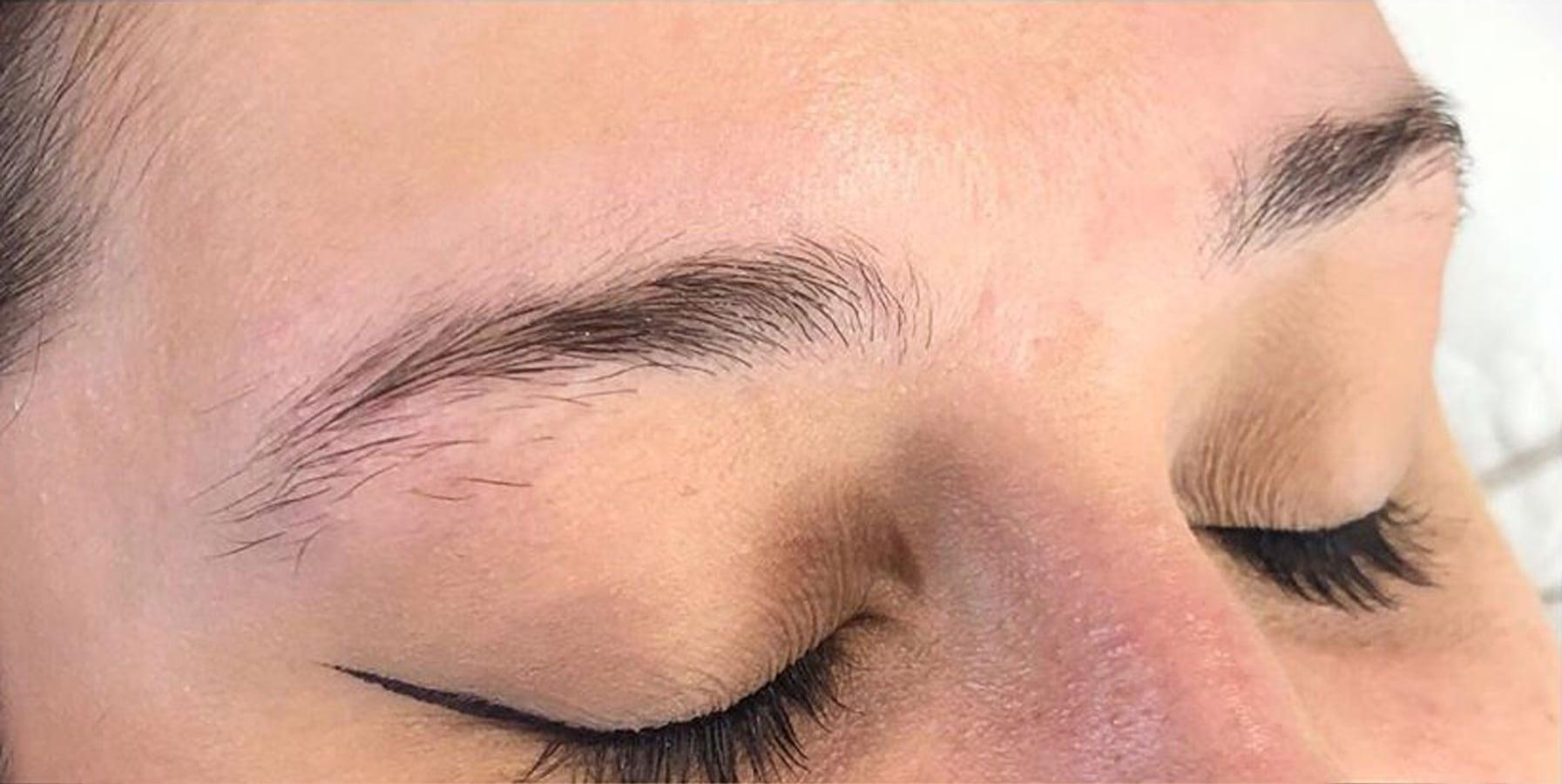 Before the treatment
