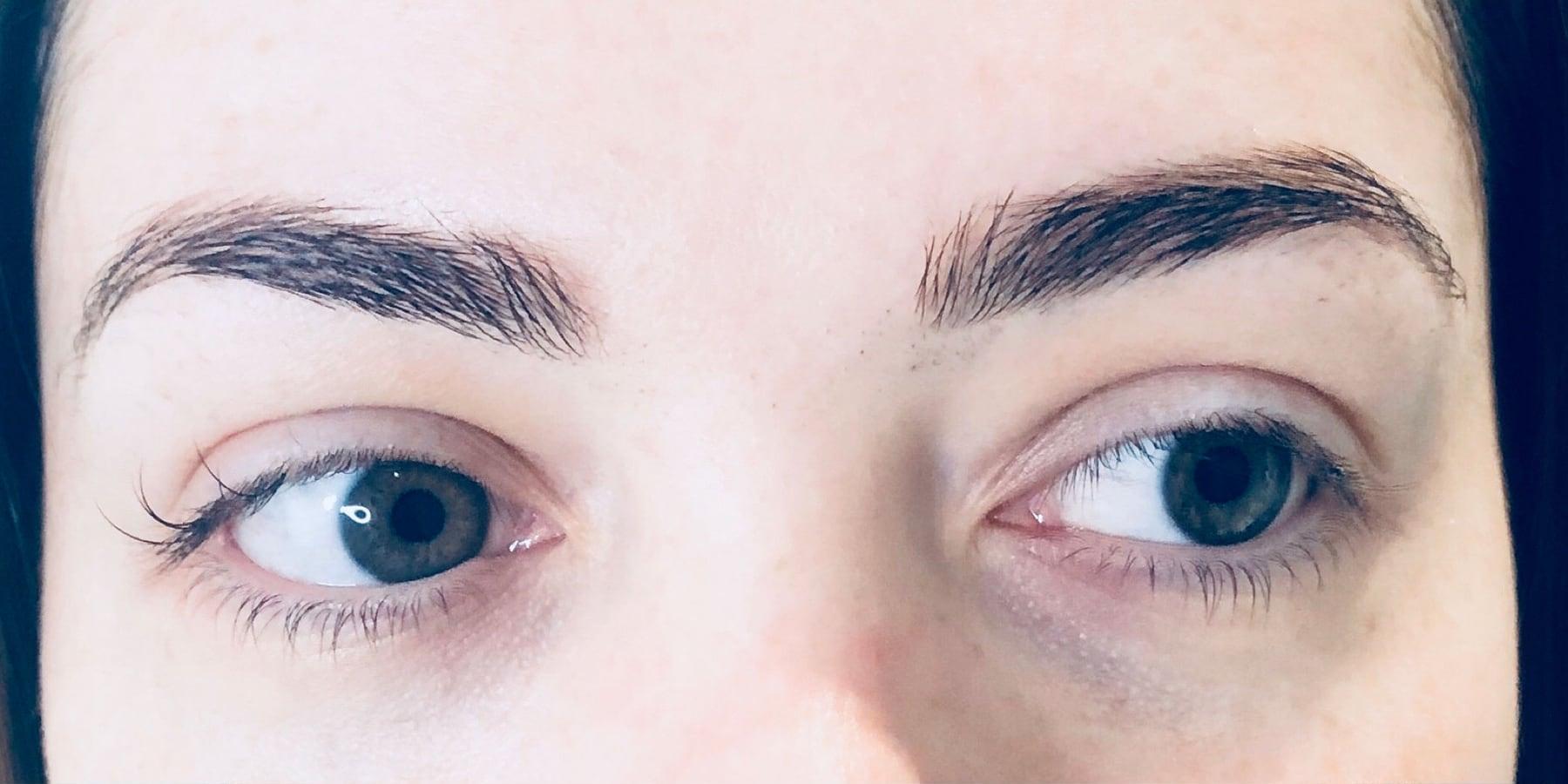Before the treatment