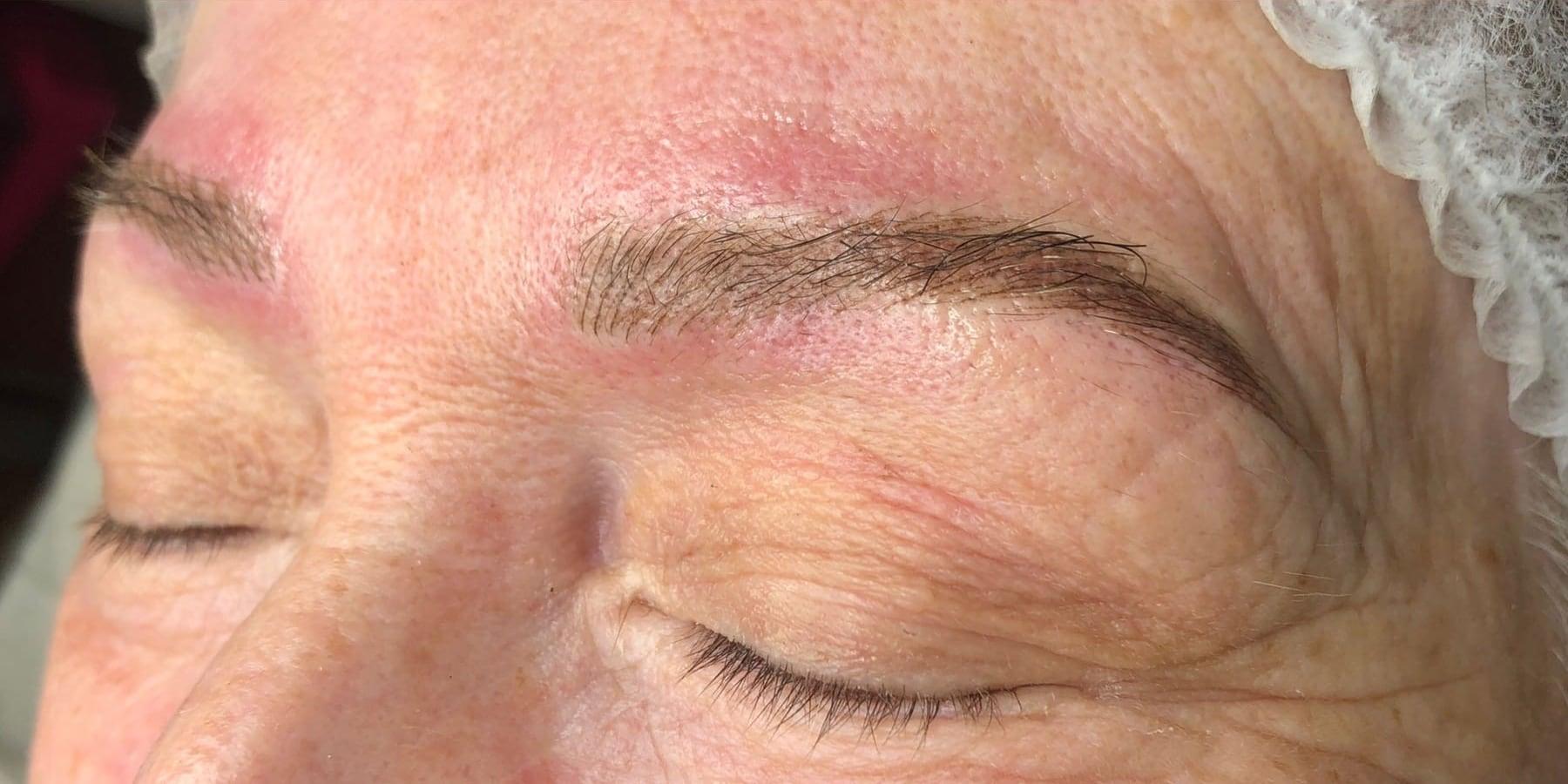 After the treatment