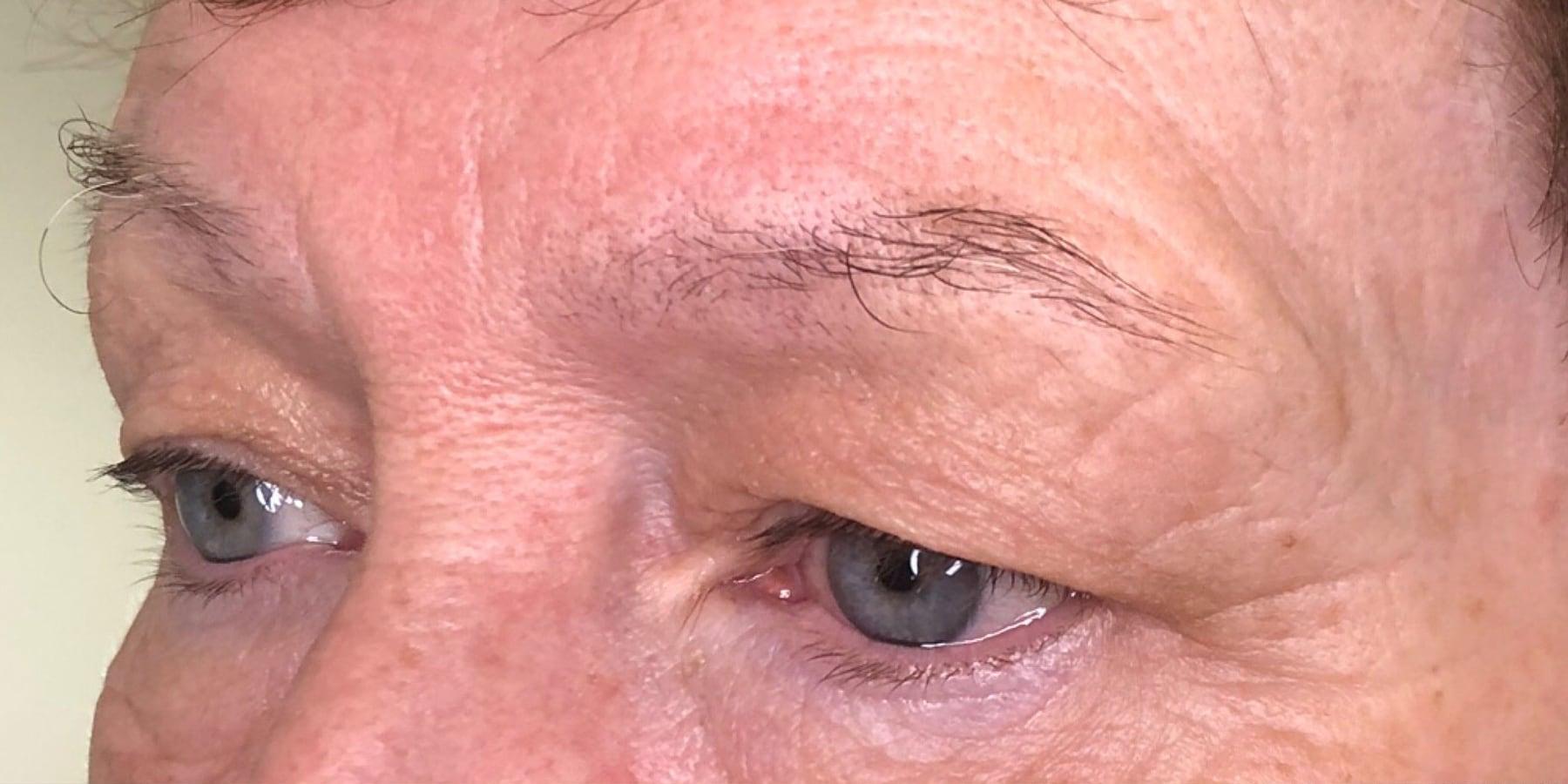 Before the treatment