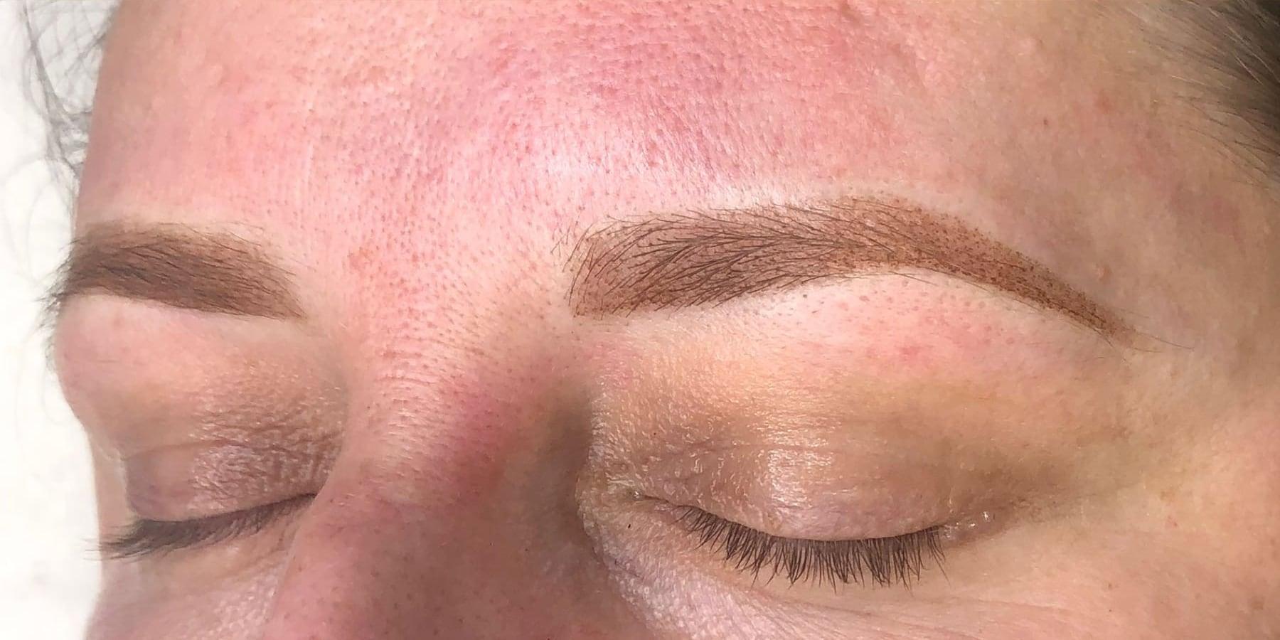 After the treatment