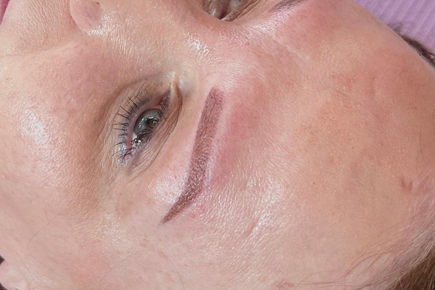 After the treatment
