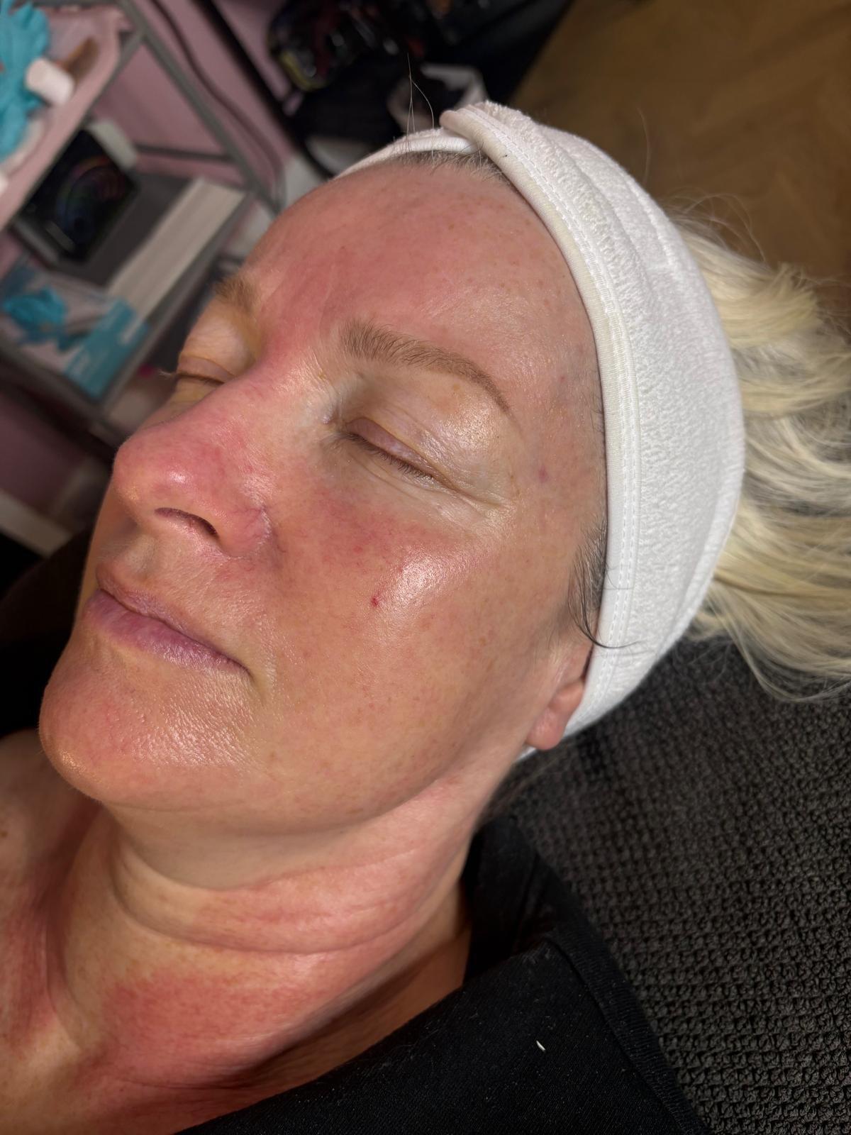 SkinBase facial by Nicola