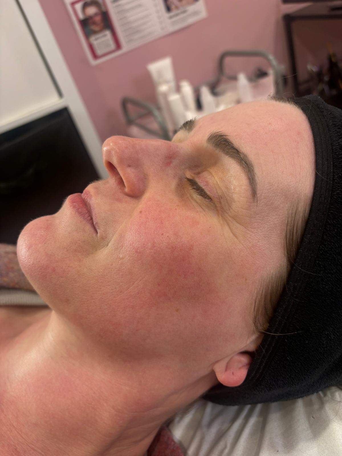 SkinBase facial by Nicola