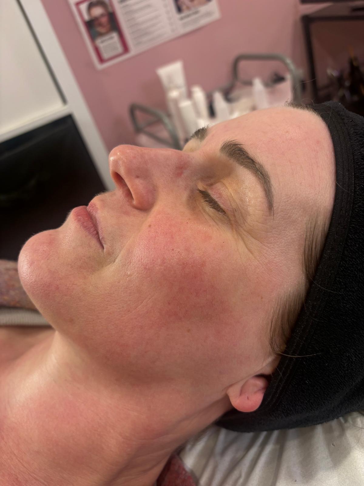 SkinBase facial by Nicola